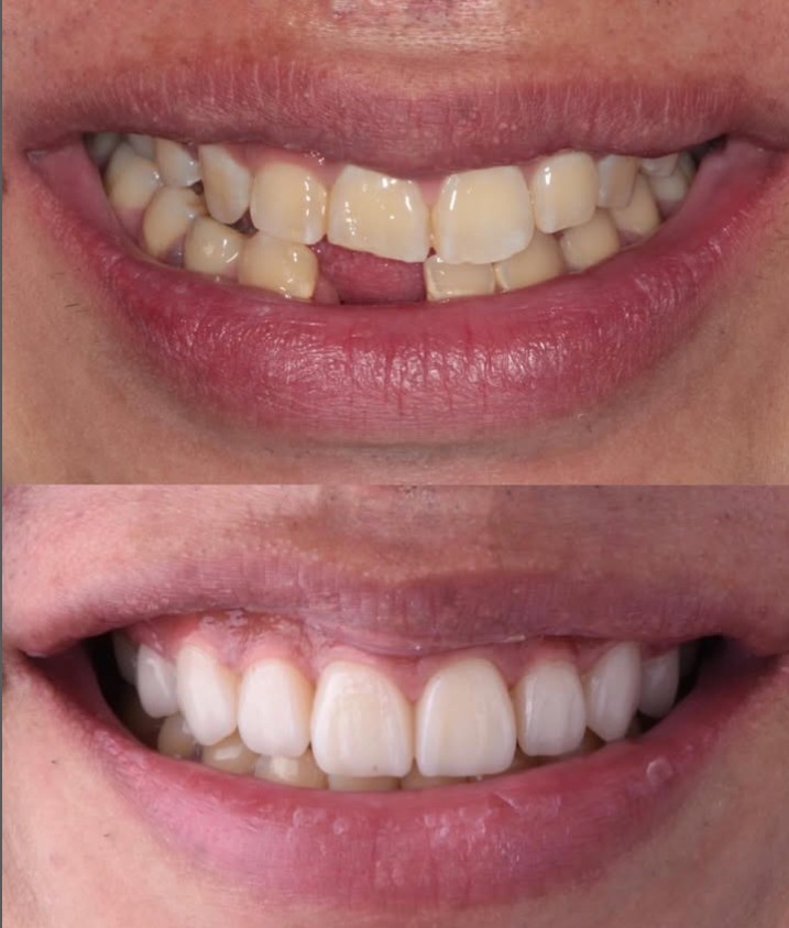 Before and After Case 1